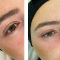 Lashlift