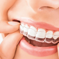 Estetisk tandvård