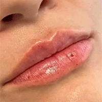 Hem